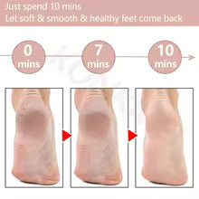 Rechargeable Foot Callus Remover With 1 Extra Head