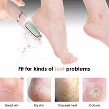 Rechargeable Foot Callus Remover With 1 Extra Head